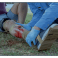 Universal Splint Medical