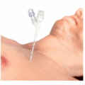 pneumothorax Chest decompression needle